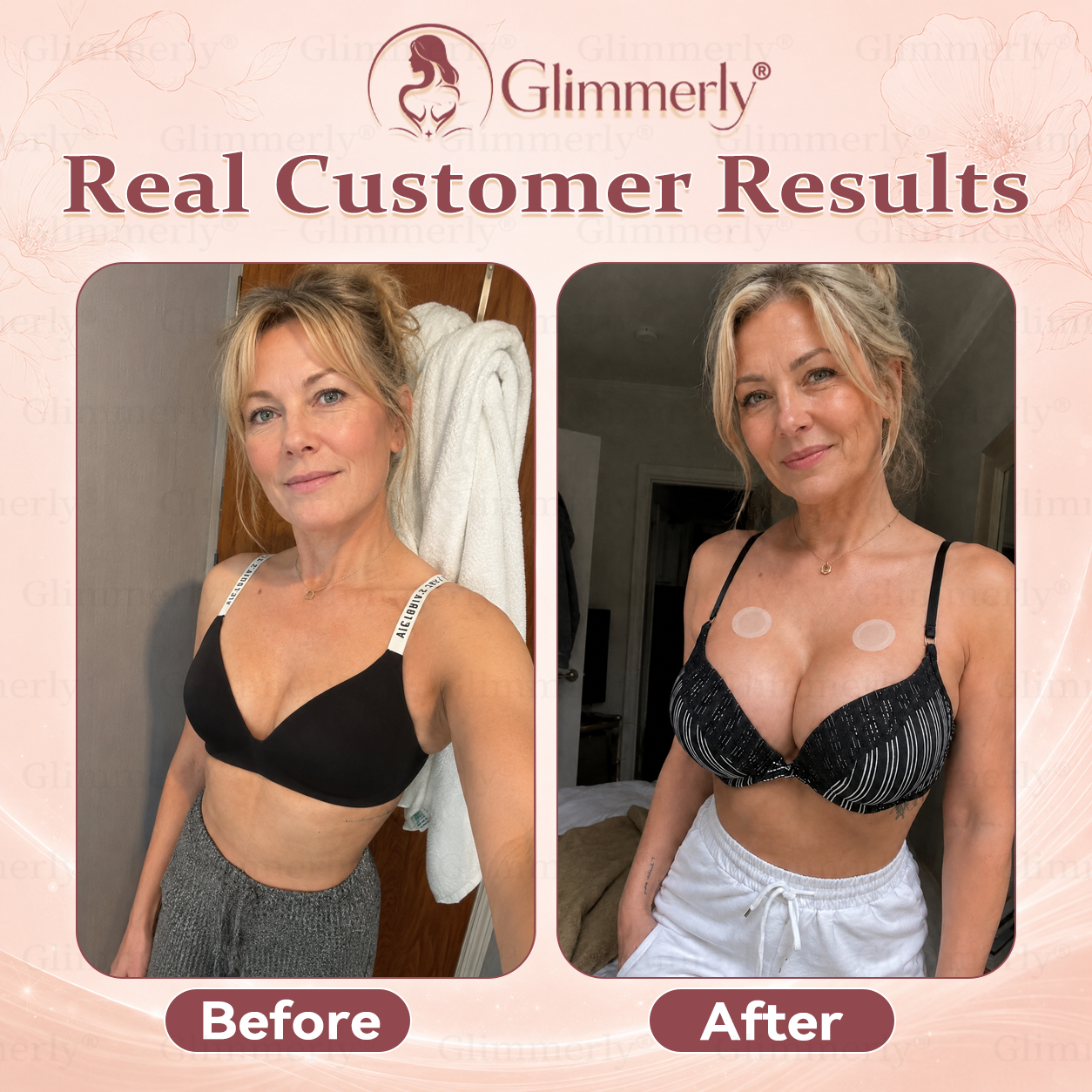 ⏰𝐆𝐥𝐢𝐦𝐦𝐞𝐫𝐥𝐲® 𝐁𝐫𝐞𝐚𝐬𝐭 𝐕𝐨𝐥𝐮𝐦𝐞 𝐁𝐨𝐨𝐬𝐭 & 𝐅𝐢𝐫𝐦 𝐌𝐢𝐜𝐫𝐨-𝐍𝐞𝐞𝐝𝐥𝐞 𝐏𝐚𝐭𝐜𝐡𝐞𝐬