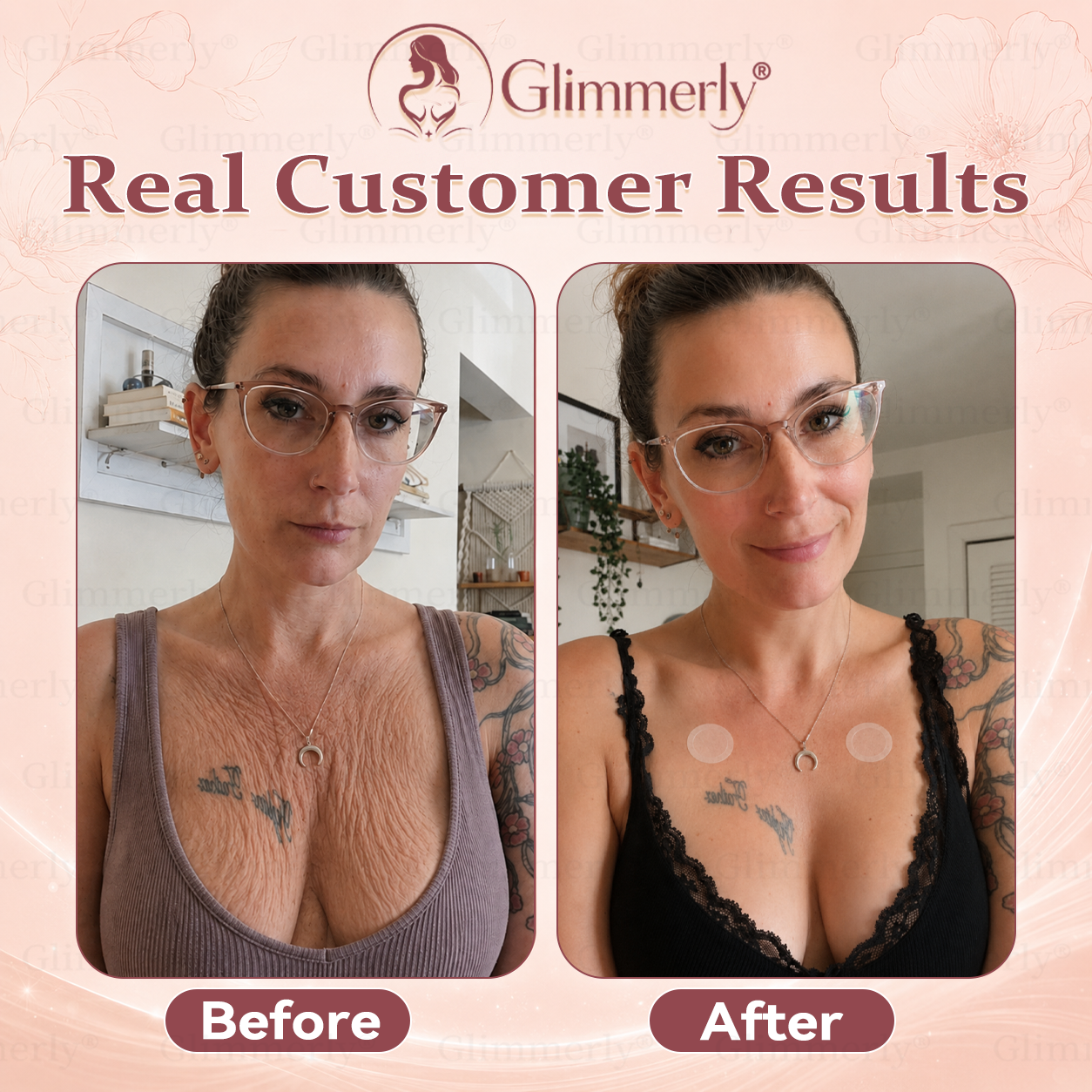 ⏰𝐆𝐥𝐢𝐦𝐦𝐞𝐫𝐥𝐲® 𝐁𝐫𝐞𝐚𝐬𝐭 𝐕𝐨𝐥𝐮𝐦𝐞 𝐁𝐨𝐨𝐬𝐭 & 𝐅𝐢𝐫𝐦 𝐌𝐢𝐜𝐫𝐨-𝐍𝐞𝐞𝐝𝐥𝐞 𝐏𝐚𝐭𝐜𝐡𝐞𝐬