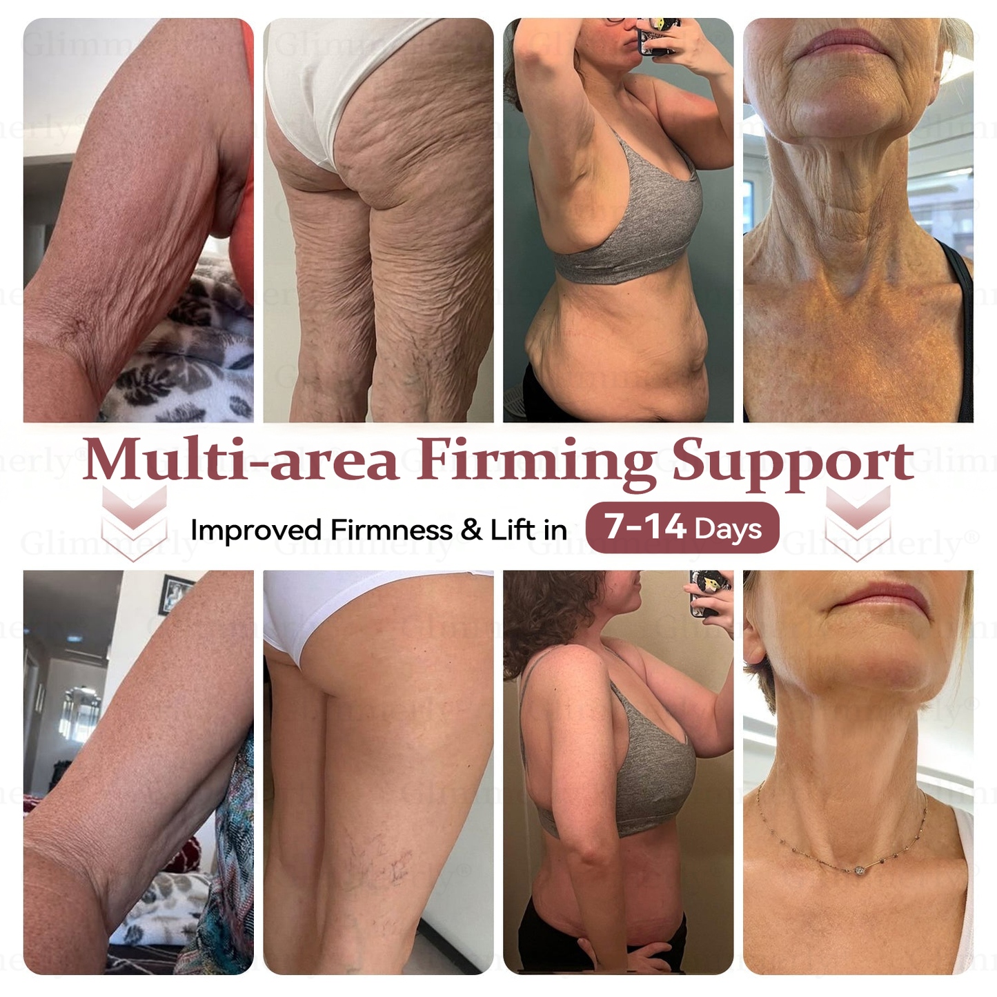 ⏰𝐆𝐥𝐢𝐦𝐦𝐞𝐫𝐥𝐲® 𝐁𝐫𝐞𝐚𝐬𝐭 𝐕𝐨𝐥𝐮𝐦𝐞 𝐁𝐨𝐨𝐬𝐭 & 𝐅𝐢𝐫𝐦 𝐌𝐢𝐜𝐫𝐨-𝐍𝐞𝐞𝐝𝐥𝐞 𝐏𝐚𝐭𝐜𝐡𝐞𝐬