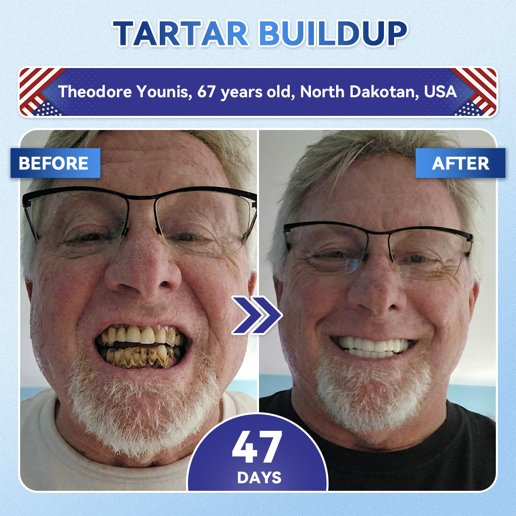 【A Game-Changer for Those with Dental Anxiety】𝐺𝑙𝑖𝑚𝑚𝑒𝑟𝑙𝑦® 𝑇𝑖𝑑𝑒𝑔𝑙𝑢𝑠𝑖𝑏 𝑇𝑜𝑜𝑡ℎ & 𝐺𝑢𝑚 𝑅𝑒𝑝𝑎𝑖𝑟 𝐹𝑎𝑠𝑡-𝐷𝑖𝑠𝑠𝑜𝑙𝑣𝑖𝑛𝑔 𝑂𝑟𝑎𝑙 𝑆𝑡𝑟𝑖𝑝𝑠(Supports tooth repair and helps relieve gum discomfort and other common oral concerns)