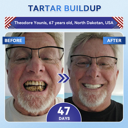 【A Game-Changer for Those with Dental Anxiety】𝐺𝑙𝑖𝑚𝑚𝑒𝑟𝑙𝑦® 𝑇𝑖𝑑𝑒𝑔𝑙𝑢𝑠𝑖𝑏 𝑇𝑜𝑜𝑡ℎ & 𝐺𝑢𝑚 𝑅𝑒𝑝𝑎𝑖𝑟 𝐹𝑎𝑠𝑡-𝐷𝑖𝑠𝑠𝑜𝑙𝑣𝑖𝑛𝑔 𝑂𝑟𝑎𝑙 𝑆𝑡𝑟𝑖𝑝𝑠(Supports tooth repair and helps relieve gum discomfort and other common oral concerns)