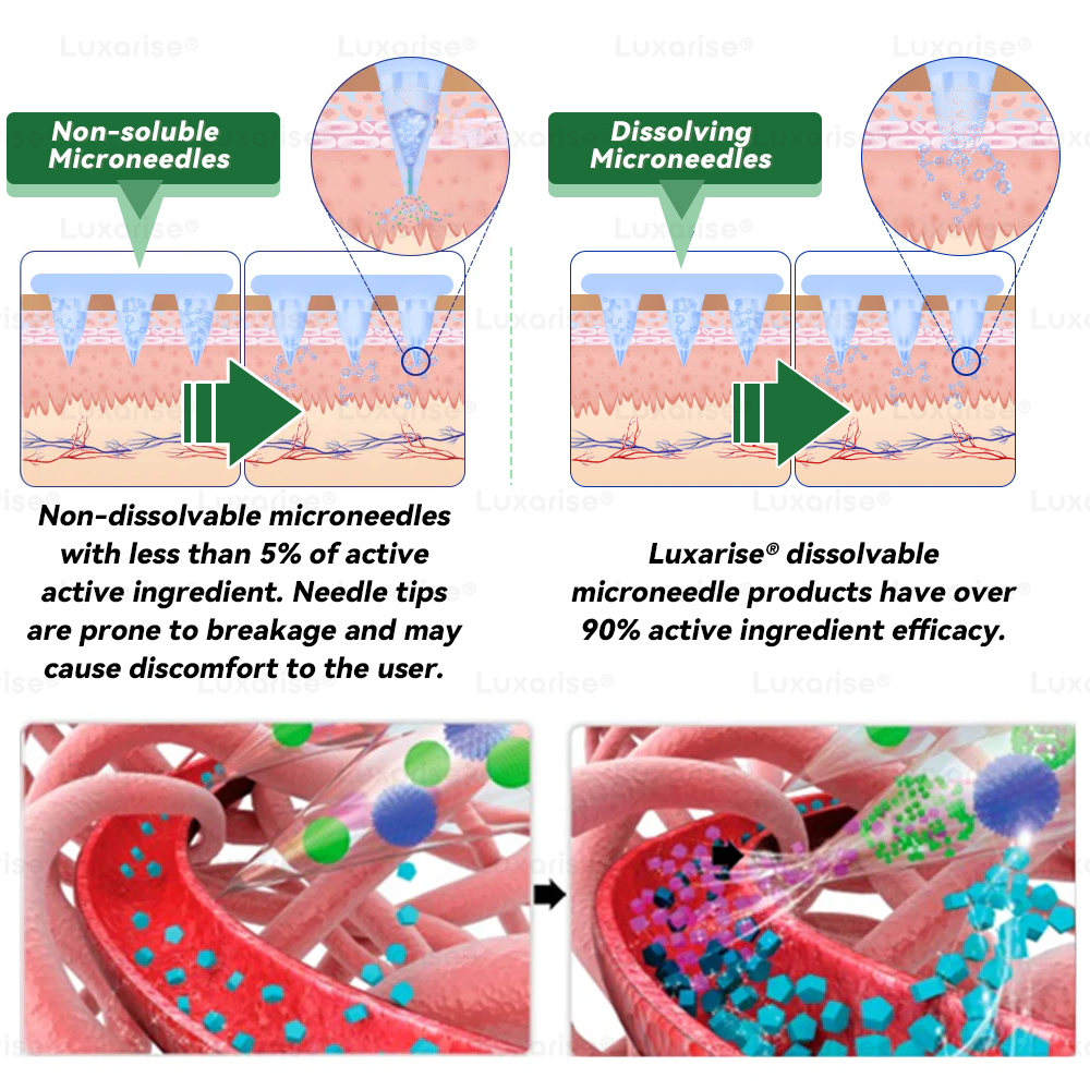 🚀 Once Daily 🚀, Visible Changes in 7 Days 𝑳𝒖𝒙𝒂𝒓𝒊𝒔𝒆® 𝑴𝒐𝒓𝒊𝒏𝒈𝒂 & 𝑩𝒆𝒓𝒃𝒆𝒓𝒊𝒏𝒆 10-𝑰𝑵-1 𝑨𝒅𝒗𝒂𝒏𝒄𝒆𝒅 𝑵𝒂𝒏𝒐 𝑴𝒊𝒄𝒓𝒐𝒏𝒆𝒆𝒅𝒍𝒆 𝑷𝒂𝒕𝒄𝒉 𝐎𝐛𝐞𝐬𝐢𝐭𝐲, 𝐃𝐢𝐚𝐛𝐞𝐭𝐞𝐬, 𝐒𝐥𝐞𝐞𝐩 𝐀𝐩𝐧𝐞𝐚, 𝐀𝐧𝐝 𝐉𝐨𝐢𝐧𝐭 𝐈𝐬𝐬𝐮𝐞𝐬