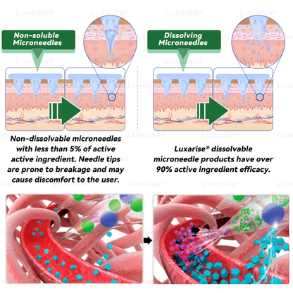 🚀 Once Daily 🚀, Visible Changes in 7 Days 𝑳𝒖𝒙𝒂𝒓𝒊𝒔𝒆® 𝑴𝒐𝒓𝒊𝒏𝒈𝒂 & 𝑩𝒆𝒓𝒃𝒆𝒓𝒊𝒏𝒆 10-𝑰𝑵-1 𝑨𝒅𝒗𝒂𝒏𝒄𝒆𝒅 𝑵𝒂𝒏𝒐 𝑴𝒊𝒄𝒓𝒐𝒏𝒆𝒆𝒅𝒍𝒆 𝑷𝒂𝒕𝒄𝒉 𝐎𝐛𝐞𝐬𝐢𝐭𝐲, 𝐃𝐢𝐚𝐛𝐞𝐭𝐞𝐬, 𝐒𝐥𝐞𝐞𝐩 𝐀𝐩𝐧𝐞𝐚, 𝐀𝐧𝐝 𝐉𝐨𝐢𝐧𝐭 𝐈𝐬𝐬𝐮𝐞𝐬