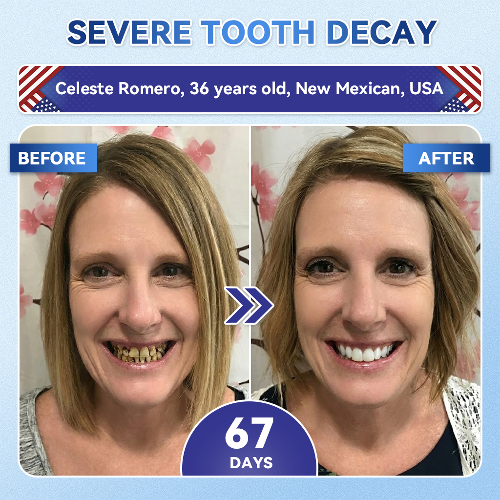 【A Game-Changer for Those with Dental Anxiety】𝐺𝑙𝑖𝑚𝑚𝑒𝑟𝑙𝑦® 𝑇𝑖𝑑𝑒𝑔𝑙𝑢𝑠𝑖𝑏 𝑇𝑜𝑜𝑡ℎ & 𝐺𝑢𝑚 𝑅𝑒𝑝𝑎𝑖𝑟 𝐹𝑎𝑠𝑡-𝐷𝑖𝑠𝑠𝑜𝑙𝑣𝑖𝑛𝑔 𝑂𝑟𝑎𝑙 𝑆𝑡𝑟𝑖𝑝𝑠(Supports tooth repair and helps relieve gum discomfort and other common oral concerns)