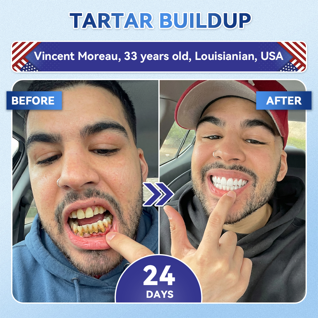 𝐺𝑙𝑖𝑚𝑚𝑒𝑟𝑙𝑦® 𝑇𝑖𝑑𝑒𝑔𝑙𝑢𝑠𝑖𝑏 𝑇𝑜𝑜𝑡ℎ & 𝐺𝑢𝑚 𝑅𝑒𝑝𝑎𝑖𝑟 𝐹𝑎𝑠𝑡-𝐷𝑖𝑠𝑠𝑜𝑙𝑣𝑖𝑛𝑔 𝑊ℎ𝑖𝑡𝑒𝑛𝑖𝑛𝑔 𝑆𝑡𝑟𝑖𝑝𝑠  (𝟓-𝐢𝐧-𝟏🦷𝐑𝐞𝐛𝐮𝐢𝐥𝐝 𝐄𝐧𝐚𝐦𝐞𝐥 & 𝐃𝐞𝐧𝐭𝐢𝐧 • 𝐒𝐭𝐫𝐞𝐧𝐠𝐭𝐡𝐞𝐧 𝐆𝐮𝐦𝐬 • 𝐄𝐫𝐚𝐝𝐢𝐜𝐚𝐭𝐞 𝐓𝐚𝐫𝐭𝐚𝐫 & 𝐎𝐝𝐨𝐫 • 𝐖𝐡𝐢𝐭𝐞𝐧𝐢𝐧𝐠 • 𝐒𝐭𝐨𝐩 𝐓𝐨𝐨𝐭𝐡 𝐒𝐞𝐧𝐬𝐢𝐭𝐢𝐯𝐢𝐭𝐲)