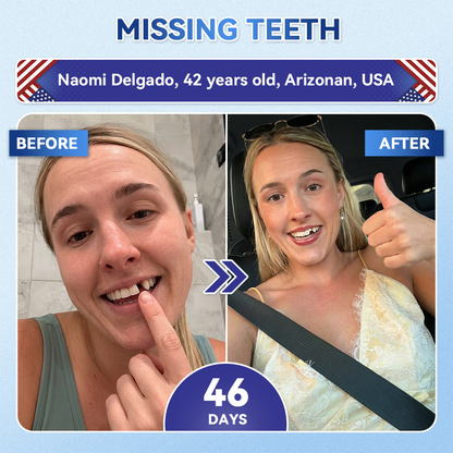 【A Game-Changer for Those with Dental Anxiety】𝐺𝑙𝑖𝑚𝑚𝑒𝑟𝑙𝑦® 𝑇𝑖𝑑𝑒𝑔𝑙𝑢𝑠𝑖𝑏 𝑇𝑜𝑜𝑡ℎ & 𝐺𝑢𝑚 𝑅𝑒𝑝𝑎𝑖𝑟 𝐹𝑎𝑠𝑡-𝐷𝑖𝑠𝑠𝑜𝑙𝑣𝑖𝑛𝑔 𝑂𝑟𝑎𝑙 𝑆𝑡𝑟𝑖𝑝𝑠(Supports tooth repair and helps relieve gum discomfort and other common oral concerns)