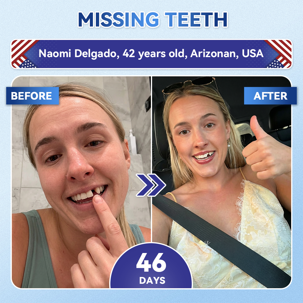 𝐺𝑙𝑖𝑚𝑚𝑒𝑟𝑙𝑦® 𝑇𝑖𝑑𝑒𝑔𝑙𝑢𝑠𝑖𝑏 𝑇𝑜𝑜𝑡ℎ & 𝐺𝑢𝑚 𝑅𝑒𝑝𝑎𝑖𝑟 𝐹𝑎𝑠𝑡-𝐷𝑖𝑠𝑠𝑜𝑙𝑣𝑖𝑛𝑔 𝑊ℎ𝑖𝑡𝑒𝑛𝑖𝑛𝑔 𝑆𝑡𝑟𝑖𝑝𝑠  (𝟓-𝐢𝐧-𝟏🦷𝐑𝐞𝐛𝐮𝐢𝐥𝐝 𝐄𝐧𝐚𝐦𝐞𝐥 & 𝐃𝐞𝐧𝐭𝐢𝐧 • 𝐒𝐭𝐫𝐞𝐧𝐠𝐭𝐡𝐞𝐧 𝐆𝐮𝐦𝐬 • 𝐄𝐫𝐚𝐝𝐢𝐜𝐚𝐭𝐞 𝐓𝐚𝐫𝐭𝐚𝐫 & 𝐎𝐝𝐨𝐫 • 𝐖𝐡𝐢𝐭𝐞𝐧𝐢𝐧𝐠 • 𝐒𝐭𝐨𝐩 𝐓𝐨𝐨𝐭𝐡 𝐒𝐞𝐧𝐬𝐢𝐭𝐢𝐯𝐢𝐭𝐲)