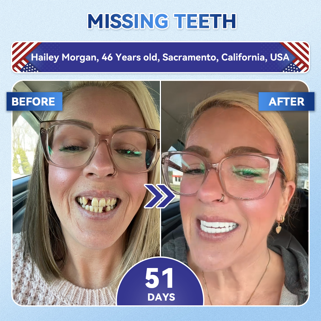 Next-Gen🦷𝐆𝐥𝐢𝐦𝐦𝐞𝐫𝐥𝐲® 𝐓𝐢𝐝𝐞𝐠𝐥𝐮𝐬𝐢𝐛 𝐓𝐨𝐨𝐭𝐡 & 𝐆𝐮𝐦 𝐑𝐞𝐩𝐚𝐢𝐫 𝐌𝐢𝐜𝐫𝐨𝐧𝐞𝐞𝐝𝐥𝐞 𝐏𝐚𝐭𝐜𝐡  | 𝐀𝐝𝐯𝐚𝐧𝐜𝐞𝐝 𝐒𝐭𝐞𝐦-𝐂𝐞𝐥𝐥 𝐀𝐜𝐭𝐢𝐯𝐚𝐭𝐢𝐨𝐧 𝐓𝐞𝐞𝐭𝐡 𝐒𝐭𝐫𝐢𝐩𝐬(🦷𝐑𝐞𝐛𝐮𝐢𝐥𝐝 𝐄𝐧𝐚𝐦𝐞𝐥 & 𝐃𝐞𝐧𝐭𝐢𝐧 • 𝐒𝐭𝐫𝐞𝐧𝐠𝐭𝐡𝐞𝐧 𝐆𝐮𝐦𝐬 • 𝐄𝐫𝐚𝐝𝐢𝐜𝐚𝐭𝐞 𝐓𝐚𝐫𝐭𝐚𝐫 & 𝐎𝐝𝐨𝐫 • 𝐒𝐭𝐨𝐩 𝐓𝐨𝐨𝐭𝐡 𝐒𝐞𝐧𝐬𝐢𝐭𝐢𝐯𝐢𝐭𝐲)