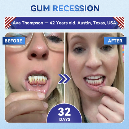 Next-Gen🦷𝐆𝐥𝐢𝐦𝐦𝐞𝐫𝐥𝐲® 𝐓𝐢𝐝𝐞𝐠𝐥𝐮𝐬𝐢𝐛 𝐓𝐨𝐨𝐭𝐡 & 𝐆𝐮𝐦 𝐑𝐞𝐩𝐚𝐢𝐫 𝐌𝐢𝐜𝐫𝐨𝐧𝐞𝐞𝐝𝐥𝐞 𝐏𝐚𝐭𝐜𝐡  | 𝐀𝐝𝐯𝐚𝐧𝐜𝐞𝐝 𝐒𝐭𝐞𝐦-𝐂𝐞𝐥𝐥 𝐀𝐜𝐭𝐢𝐯𝐚𝐭𝐢𝐨𝐧 𝐓𝐞𝐞𝐭𝐡 𝐒𝐭𝐫𝐢𝐩𝐬(🦷𝐑𝐞𝐛𝐮𝐢𝐥𝐝 𝐄𝐧𝐚𝐦𝐞𝐥 & 𝐃𝐞𝐧𝐭𝐢𝐧 • 𝐒𝐭𝐫𝐞𝐧𝐠𝐭𝐡𝐞𝐧 𝐆𝐮𝐦𝐬 • 𝐄𝐫𝐚𝐝𝐢𝐜𝐚𝐭𝐞 𝐓𝐚𝐫𝐭𝐚𝐫 & 𝐎𝐝𝐨𝐫 • 𝐒𝐭𝐨𝐩 𝐓𝐨𝐨𝐭𝐡 𝐒𝐞𝐧𝐬𝐢𝐭𝐢𝐯𝐢𝐭𝐲)